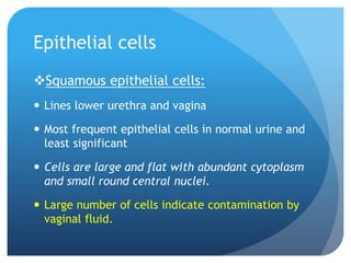 Epithelial cells
Squamous epithelial cells:
 Lines lower urethra and vagina
 Most frequent epithelial cells in normal urine and
least significant
 Cells are large and flat with abundant cytoplasm
and small round central nuclei.
 Large number of cells indicate contamination by
vaginal fluid.
 