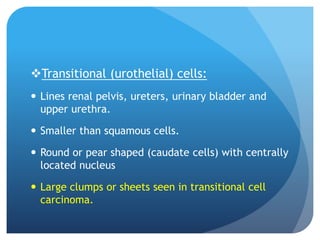 Transitional (urothelial) cells:
 Lines renal pelvis, ureters, urinary bladder and
upper urethra.
 Smaller than squamous cells.
 Round or pear shaped (caudate cells) with centrally
located nucleus
 Large clumps or sheets seen in transitional cell
carcinoma.
 