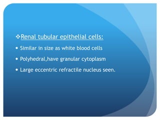 Renal tubular epithelial cells:
 Similar in size as white blood cells
 Polyhedral,have granular cytoplasm
 Large eccentric refractile nucleus seen.
 