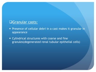 Granular casts:
 Presence of cellular debri in a cast makes it granular in
appearance
 Cylindrical structures with coarse and fine
granules(degenerated renal tubular epithelial cells)
 