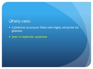 Fatty casts:
 Cylindrical structures filled with highly refractile fat
globules
 Seen in nephrotic syndrome
 