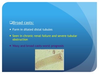 Broad casts:
 Form in dilated distal tubules
 Seen in chronic renal failure and severe tubular
obstruction
 Waxy and broad casts-worst prognosis
 