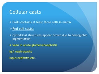 Cellular casts
 Casts contains at least three cells in matrix
Red cell casts:
 Cylindrical structures,appear brown due to hemoglobin
pigmentation
 Seen in acute glomerulonephritis
Ig A nephropathy
lupus nephritis etc.
 