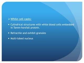 White cell casts:
 Cylindrical structures with white blood cells embedded
in Tamm-horsfall protein.
 Refractile and exhibit granules
 Multi-lobed nucleus
 