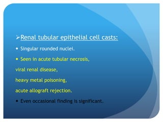 Renal tubular epithelial cell casts:
 Singular rounded nuclei.
 Seen in acute tubular necrosis,
viral renal disease,
heavy metal poisoning,
acute allograft rejection.
 Even occasional finding is significant.
 