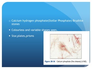 o Calcium hydrogen phosphate(Stellar Phosphate)-Brushite
stones
 Colourless and variable shapes seen.
 Star,plates,prisms
 