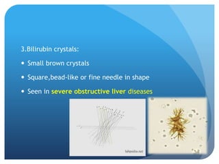 3.Bilirubin crystals:
 Small brown crystals
 Square,bead-like or fine needle in shape
 Seen in severe obstructive liver diseases
 
