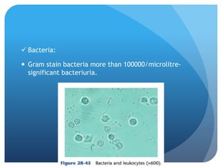  Bacteria:
 Gram stain bacteria more than 100000/microlitre-
significant bacteriuria.
 