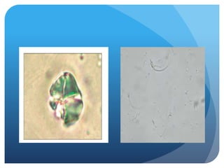 Urine analysis microscopic examination
