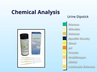 Chemical Analysis
Urine Dipstick
Glucose
Bilirubin
Ketones
Specific Gravity
Blood
pH
Protein
Urobilinogen
Nitrite
Leukocyte Esterase
 