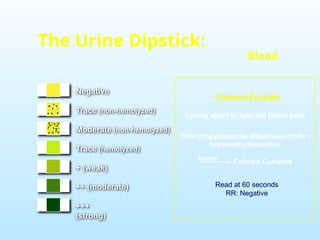 Negative
Trace (non-hemolyzed)
Moderate (non-hemolyzed)
Trace (hemolyzed)
+ (weak)
++ (moderate)
+++
(strong)
The Urine Dipstick:
Blood
Diisopropylbenzene dihydroperoxide +
Tetramethylbenzidine
------------> Colored Complex
Heme
Chemical Principle
Lysing agent to lyse red blood cells
Read at 60 seconds
RR: Negative
 