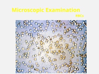 Microscopic Examination
RBCs
 