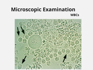 Microscopic Examination
WBCs
 