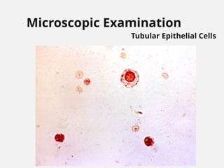 Microscopic Examination
Tubular Epithelial Cells
 
