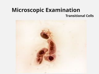 Microscopic Examination
Transitional Cells
 