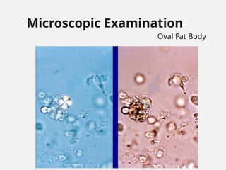 Microscopic Examination
Oval Fat Body
 
