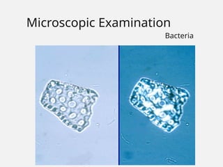 Microscopic Examination
Bacteria
 