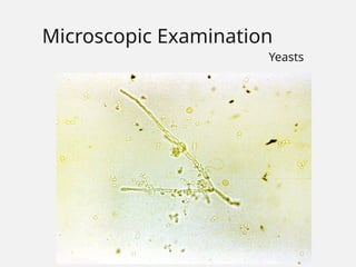 Microscopic Examination
Yeasts
 