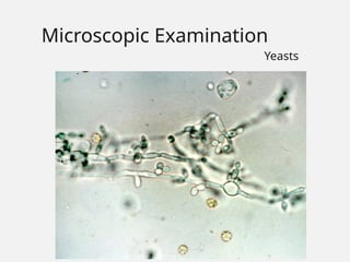 Microscopic Examination
Yeasts
 