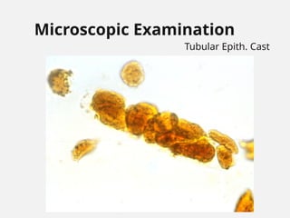 Microscopic Examination
Tubular Epith. Cast
 