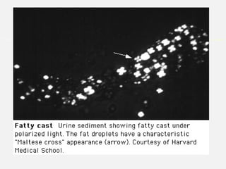 ©2005 UpToDate
®
e-mail this to a colleague
 