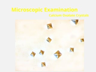Microscopic Examination
Calcium Oxalate Crystals
 
