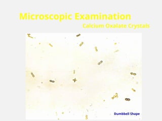 Microscopic Examination
Calcium Oxalate Crystals
Dumbbell Shape
 