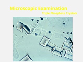 Microscopic Examination
Triple Phosphate Crystals
 
