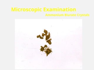 Microscopic Examination
Ammonium Biurate Crystals
 