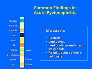 Trace
Positive
Positive
Microscopic:
• Bacteria
• Leukocytes
• Leukocyte, granular, and
waxy casts
• Renal tubular epithelial
cell casts
Common Findings in:
Acute Pyelonephritis
Glucose
Bilirubin
Ketones
S.G.
Blood
pH
Protein
Nitrite
L.E.
Urobilinogen
 