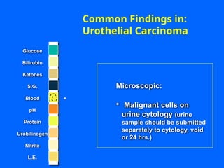Common Findings in:
Urothelial Carcinoma
Microscopic:
• Malignant cells on
urine cytology (urine
sample should be submitted
separately to cytology, void
or 24 hrs.)
Glucose
Bilirubin
Ketones
S.G.
Blood
pH
Protein
Nitrite
L.E.
Urobilinogen
+
 