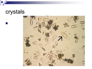 crystals

 