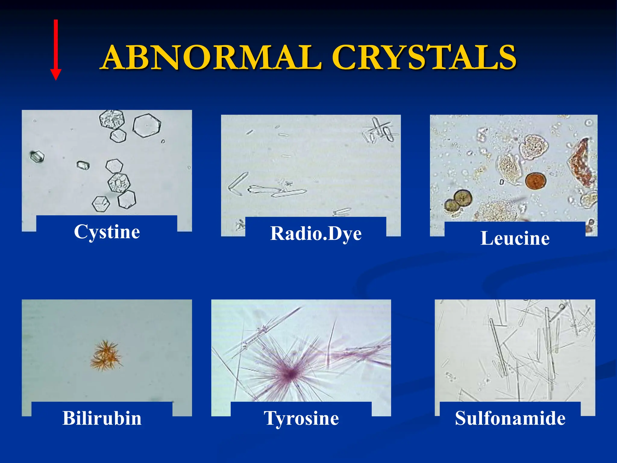 Urine and Stool analysis.ppt urine and stool analysis | PPT