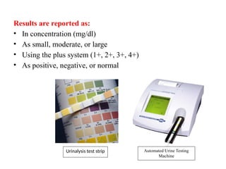 Urine R M Test Biochemical routine urine analysis: an overview.pptx