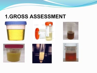 1.GROSS ASSESSMENT
Colors
 