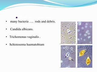  3. Micro-organisms
• many bacteria …. rods and debris.
• Candida albicans.
• Trichomonas vaginalis .
• Schistosoma haematobium
 