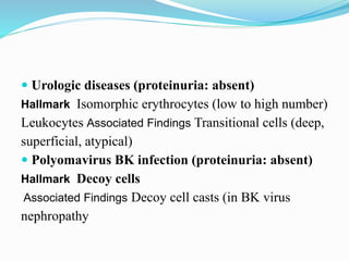  Urologic diseases (proteinuria: absent)
Hallmark Isomorphic erythrocytes (low to high number)
Leukocytes Associated Findings Transitional cells (deep,
superficial, atypical)
 Polyomavirus BK infection (proteinuria: absent)
Hallmark Decoy cells
Associated Findings Decoy cell casts (in BK virus
nephropathy
 
