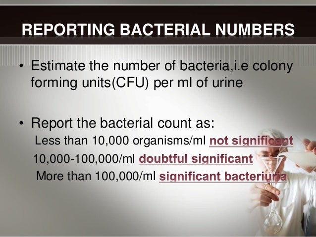 urine-examination