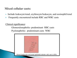 Include leukocyte/renal, erythrocyte/leukocyte, and eosinophil/renal
 Frequently encountered include RBC and WBC casts
Clinical significance:
Glomerulonephritis- predominant RBC casts
Pyelonephritis- predominant casts WBC
 