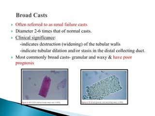  Often referred to as renal failure casts
 Diameter 2-6 times that of normal casts.
 Clinical significance:
-indicates destruction (widening) of the tubular walls
-indicate tubular dilation and/or stasis in the distal collecting duct.
 Most commonly broad casts- granular and waxy & have poor
prognosis
 