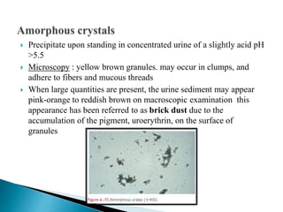  Precipitate upon standing in concentrated urine of a slightly acid pH
>5.5
 Microscopy : yellow brown granules. may occur in clumps, and
adhere to fibers and mucous threads
 When large quantities are present, the urine sediment may appear
pink-orange to reddish brown on macroscopic examination this
appearance has been referred to as brick dust due to the
accumulation of the pigment, uroerythrin, on the surface of
granules
 