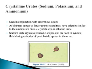  Seen in conjunction with amorphous urates
 Acid urates appear as larger granules and may have spicules similar
to the ammonium biurate crystals seen in alkaline urine
 Sodium urate crystals are needle-shaped and are seen in synovial
fluid during episodes of gout, but do appear in the urine.
 