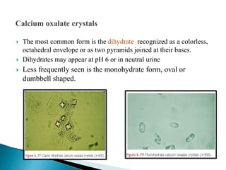  The most common form is the dihydrate recognized as a colorless,
octahedral envelope or as two pyramids joined at their bases.
 Dihydrates may appear at pH 6 or in neutral urine
 Less frequently seen is the monohydrate form, oval or
dumbbell shaped.
 
