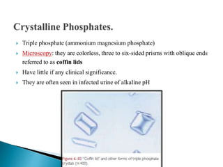  Triple phosphate (ammonium magnesium phosphate)
 Microscopy: they are colorless, three to six-sided prisms with oblique ends
referred to as coffin lids
 Have little if any clinical significance.
 They are often seen in infected urine of alkaline pH
 