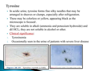  In acidic urine, tyrosine forms fine silky needles that may be
arranged in sheaves or clumps, especially after refrigeration.
 These may be colorless or yellow, appearing black as the
microscope is focused .
 They are soluble in alkali (ammonia and potassium hydroxide) and
dil HCL; they are not soluble in alcohol or ether.
 Clinical significance:
1. Tyrosinemia
2. Occasionally seen in the urine of patients with severe liver disease
 