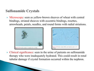  Microscopy: seen as yellow-brown sheaves of wheat with central
bindings, striated sheaves with eccentric bindings, rosettes,
arrowheads, petals, needles, and round forms with radial striations.
 Clinical significance: seen in the urine of patients on sulfonamide
therapy who were inadequately hydrated. This could result in renal
tubular damage if crystal formation occurred within the nephron.
 