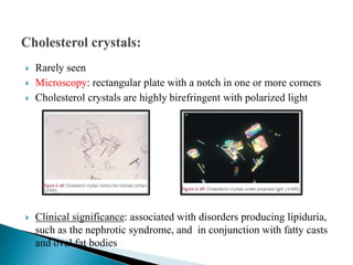  Rarely seen
 Microscopy: rectangular plate with a notch in one or more corners
 Cholesterol crystals are highly birefringent with polarized light
 Clinical significance: associated with disorders producing lipiduria,
such as the nephrotic syndrome, and in conjunction with fatty casts
and oval fat bodies
 