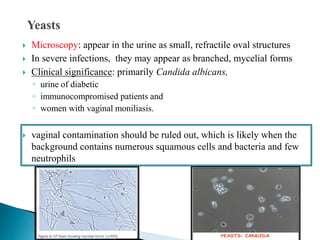  Microscopy: appear in the urine as small, refractile oval structures
 In severe infections, they may appear as branched, mycelial forms
 Clinical significance: primarily Candida albicans,
◦ urine of diabetic
◦ immunocompromised patients and
◦ women with vaginal moniliasis.
 vaginal contamination should be ruled out, which is likely when the
background contains numerous squamous cells and bacteria and few
neutrophils
 
