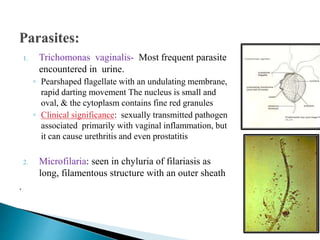 1. Trichomonas vaginalis- Most frequent parasite
encountered in urine.
◦ Pearshaped flagellate with an undulating membrane,
rapid darting movement The nucleus is small and
oval, & the cytoplasm contains fine red granules
◦ Clinical significance: sexually transmitted pathogen
associated primarily with vaginal inflammation, but
it can cause urethritis and even prostatitis
2. Microfilaria: seen in chyluria of filariasis as
long, filamentous structure with an outer sheath
.
 