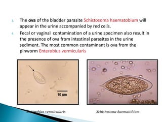 3. The ova of the bladder parasite Schistosoma haematobium will
appear in the urine accompanied by red cells.
4. Fecal or vaginal contamination of a urine specimen also result in
the presence of ova from intestinal parasites in the urine
sediment. The most common contaminant is ova from the
pinworm Enterobius vermicularis
Enterobius vermicularis Schistosoma haematobium
 